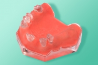 Modèle transparent de la mâchoire avec des dents 10-2156