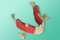 10-1039 Le modèle de la mandibule avec muqueuse pour l'entraînement à l'extraction des den